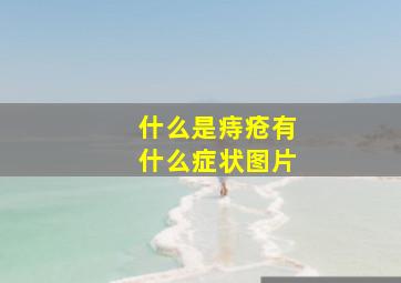 什么是痔疮有什么症状图片