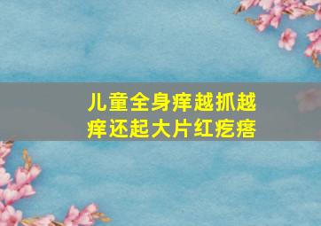 儿童全身痒越抓越痒还起大片红疙瘩