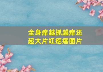 全身痒越抓越痒还起大片红疙瘩图片