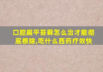 口腔扁平苔藓怎么治才能彻底根除,吃什么西药疗效快