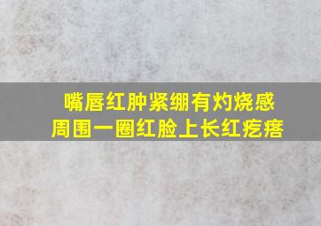 嘴唇红肿紧绷有灼烧感周围一圈红脸上长红疙瘩