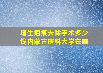 增生疤痕去除手术多少钱内蒙古医科大学在哪