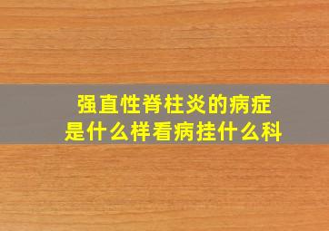 强直性脊柱炎的病症是什么样看病挂什么科