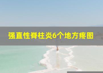 强直性脊柱炎6个地方疼图