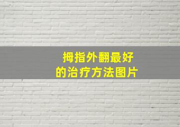 拇指外翻最好的治疗方法图片