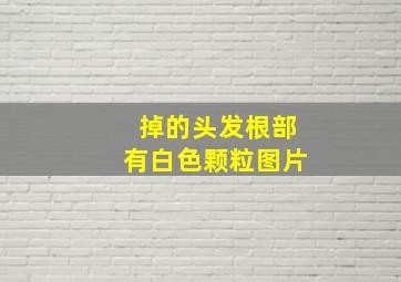 掉的头发根部有白色颗粒图片