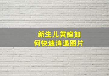 新生儿黄疸如何快速消退图片