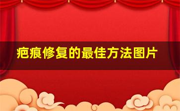 疤痕修复的最佳方法图片