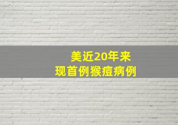 美近20年来现首例猴痘病例