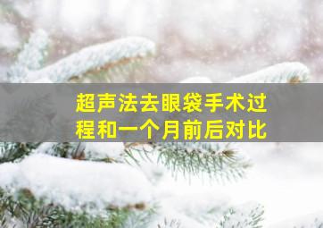 超声法去眼袋手术过程和一个月前后对比