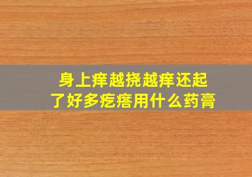 身上痒越挠越痒还起了好多疙瘩用什么药膏