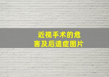 近视手术的危害及后遗症图片