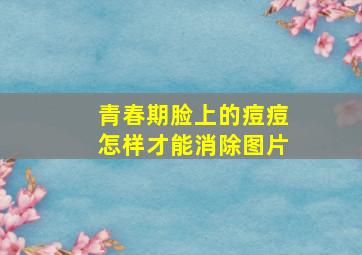 青春期脸上的痘痘怎样才能消除图片