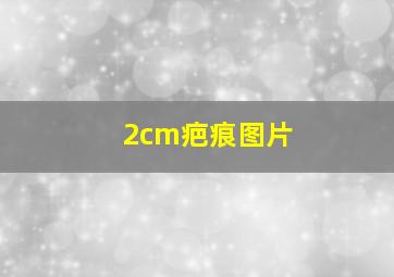 2cm疤痕图片